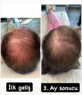 Ekran Alıntısı