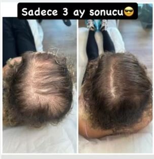 Ekran Alıntısı_