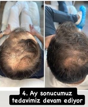 Ekran Alıntısı_1