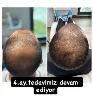 Ekran Alıntısı_2