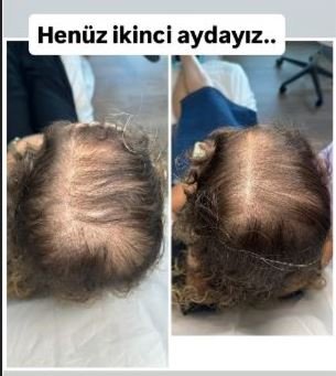 Ekran Alıntısı_3